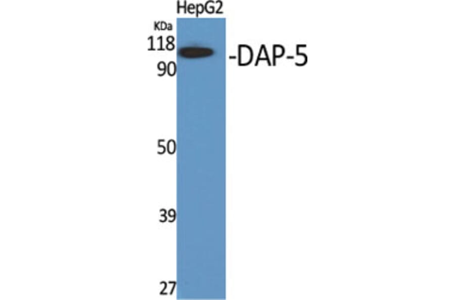 Western Blot - Anti-EIF4G2 Antibody (C13062) - Antibodies.com