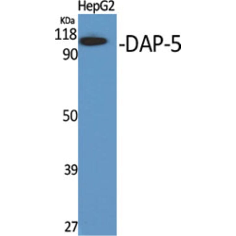 Western Blot - Anti-EIF4G2 Antibody (C13062) - Antibodies.com