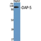 Western Blot - Anti-EIF4G2 Antibody (C13062) - Antibodies.com