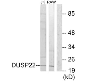 Western Blot - Anti-DUSP22 Antibody (C11753) - Antibodies.com