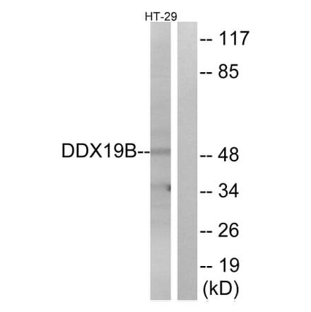 Western Blot - Anti-DDX19B Antibody (C14648) - Antibodies.com