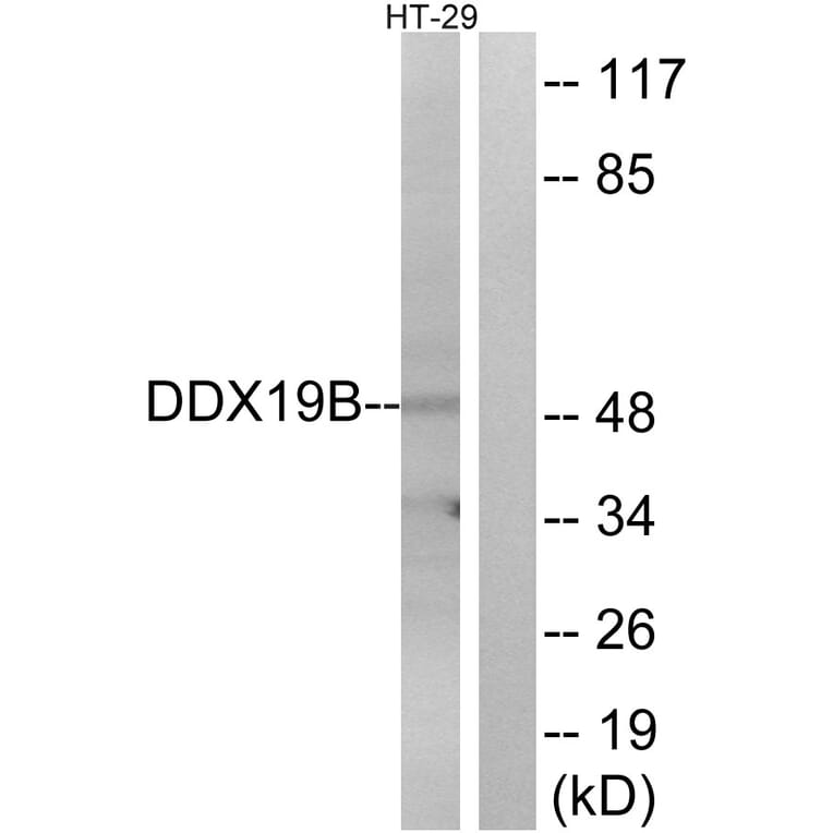 Western Blot - Anti-DDX19B Antibody (C14648) - Antibodies.com