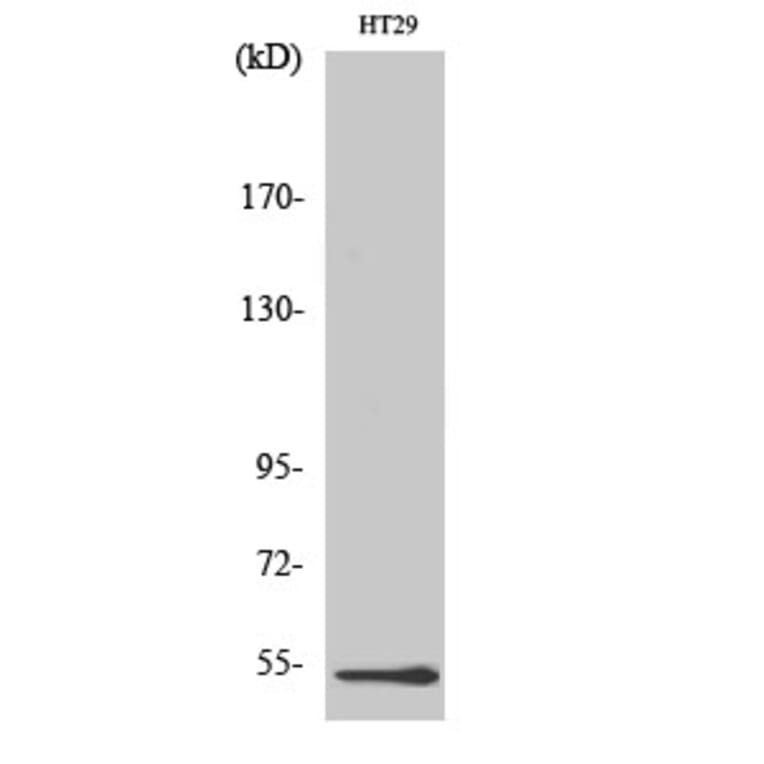 Western Blot - Anti-DDX19B Antibody (C14648) - Antibodies.com