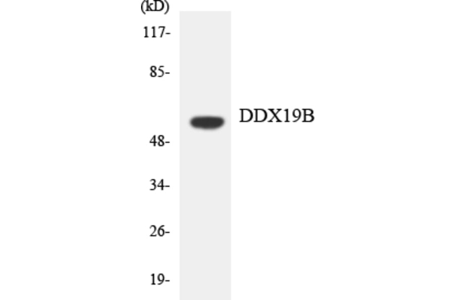 Western Blot - Anti-DDX19B Antibody (R12-2690) - Antibodies.com