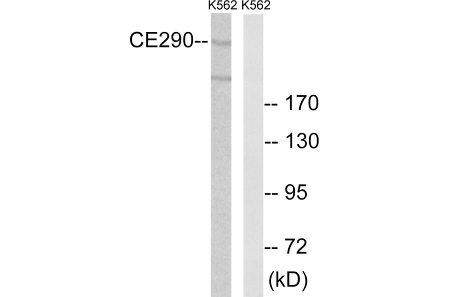 Western Blot - Anti-CEP290 Antibody (C15036) - Antibodies.com