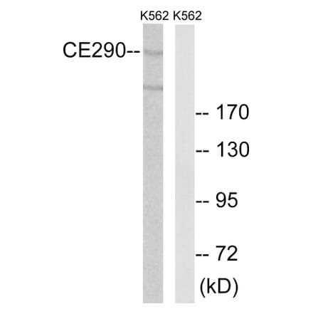 Western Blot - Anti-CEP290 Antibody (C15036) - Antibodies.com