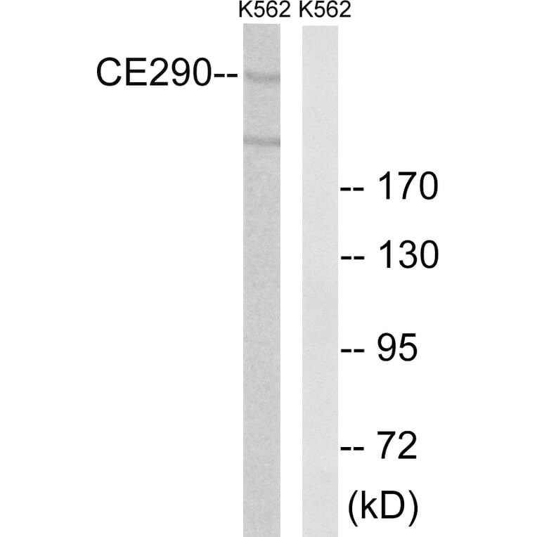 Western Blot - Anti-CEP290 Antibody (C15036) - Antibodies.com