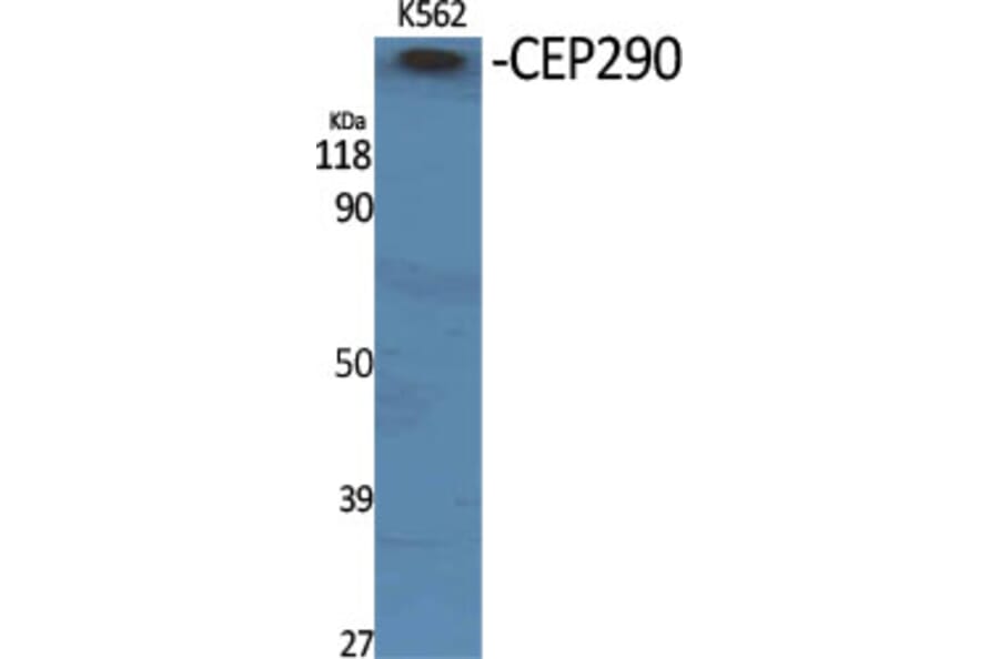 Western Blot - Anti-CEP290 Antibody (C15036) - Antibodies.com