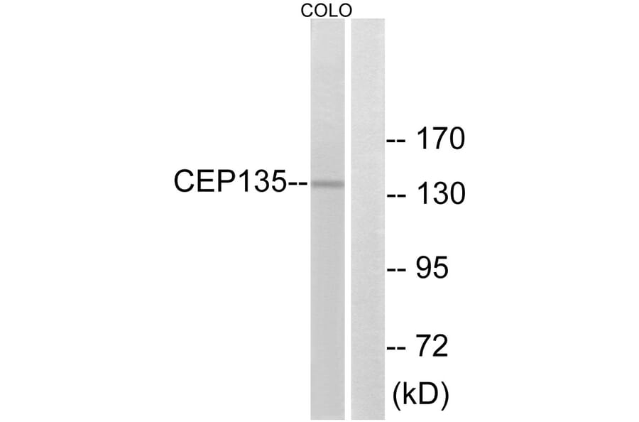Western Blot - Anti-CEP135 Antibody (C15038) - Antibodies.com