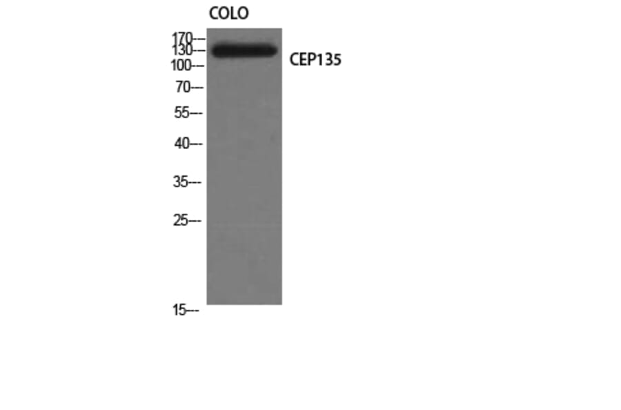 Western Blot - Anti-CEP135 Antibody (C15038) - Antibodies.com