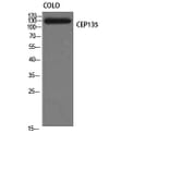 Western Blot - Anti-CEP135 Antibody (C15038) - Antibodies.com