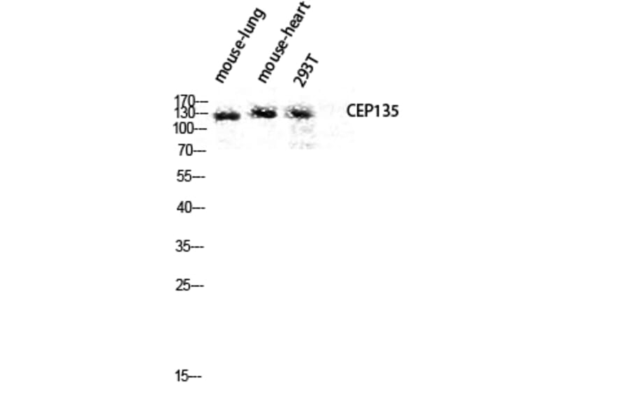 Western Blot - Anti-CEP135 Antibody (C15038) - Antibodies.com