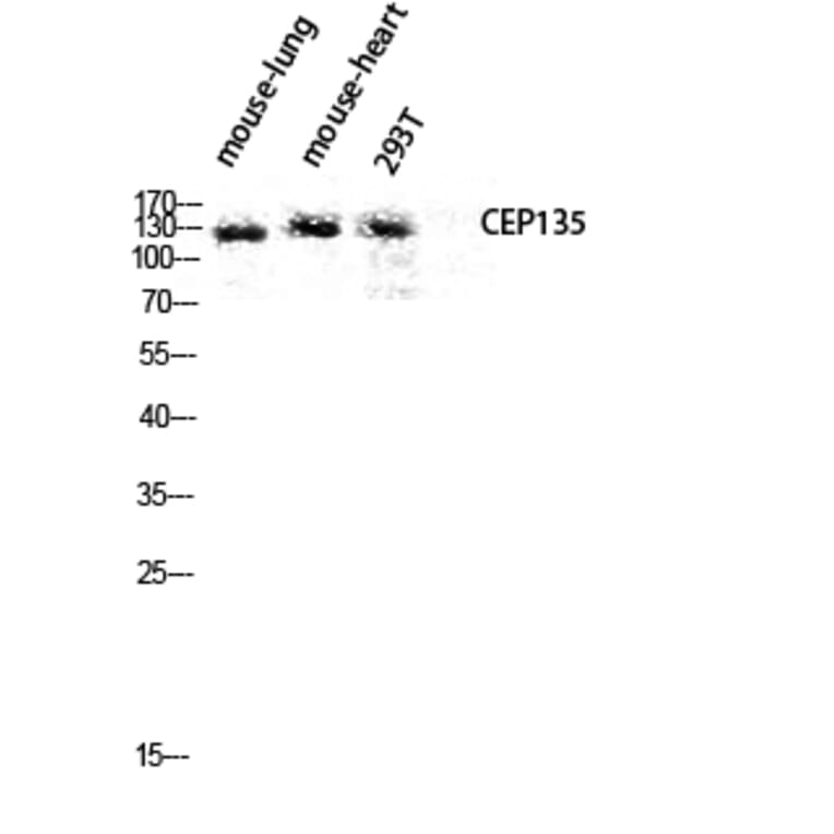 Western Blot - Anti-CEP135 Antibody (C15038) - Antibodies.com