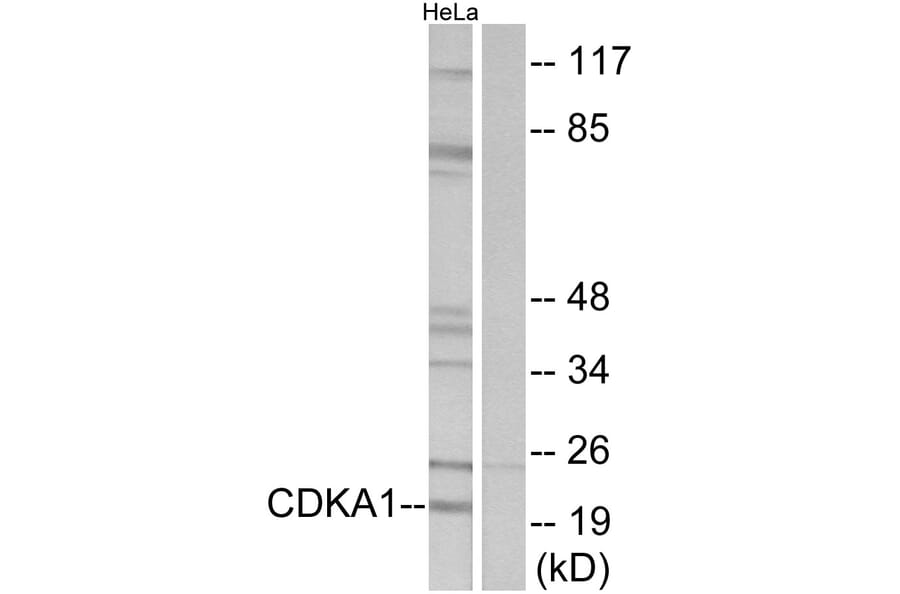 Western Blot - Anti-CDKAP1 Antibody (C10037) - Antibodies.com