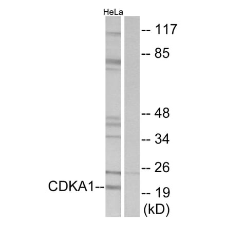 Western Blot - Anti-CDKAP1 Antibody (C10037) - Antibodies.com