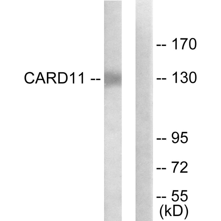Western Blot - Anti-CARD11 Antibody (C12113) - Antibodies.com