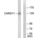 Western Blot - Anti-CARD11 Antibody (C12113) - Antibodies.com