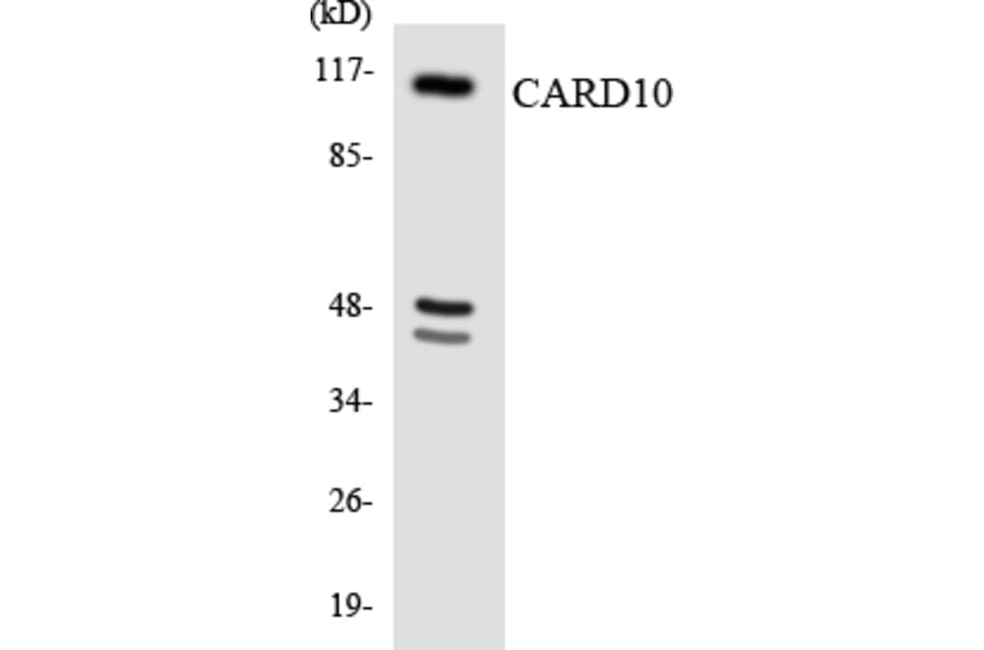 Western Blot - Anti-CARD10 Antibody (R12-2569) - Antibodies.com