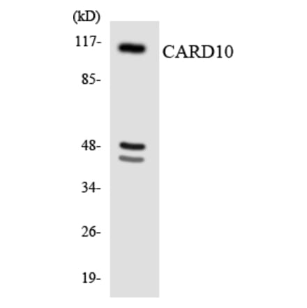 Western Blot - Anti-CARD10 Antibody (R12-2569) - Antibodies.com