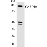 Western Blot - Anti-CARD10 Antibody (R12-2569) - Antibodies.com