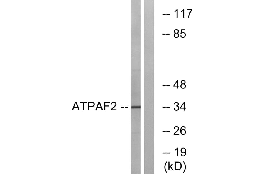 Western Blot - Anti-ATPAF2 Antibody (C14600) - Antibodies.com