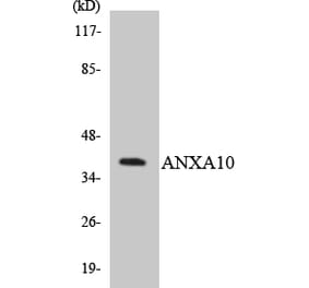 Western Blot - Anti-ANXA10 Antibody (R12-2489) - Antibodies.com