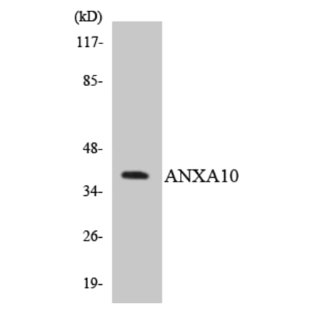 Western Blot - Anti-ANXA10 Antibody (R12-2489) - Antibodies.com
