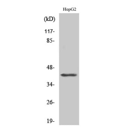 Western Blot - Anti-ACTBL2 Antibody (C21242) - Antibodies.com