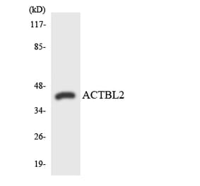 Western Blot - Anti-ACTBL2 Antibody (R12-2440) - Antibodies.com