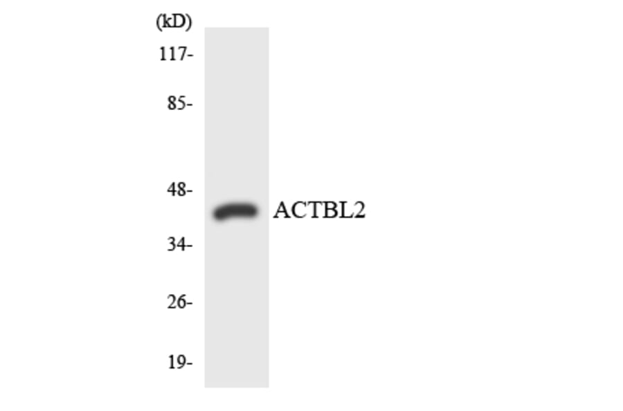 Western Blot - Anti-ACTBL2 Antibody (R12-2440) - Antibodies.com