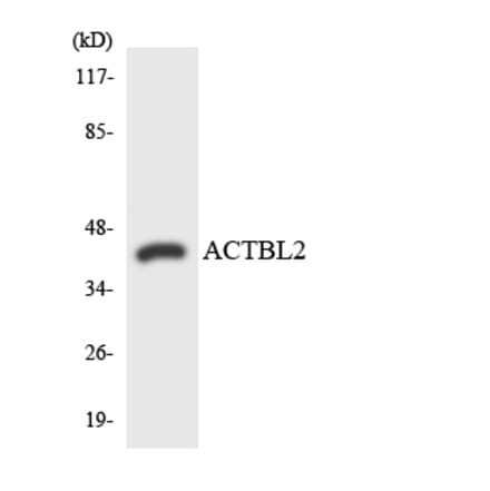 Western Blot - Anti-ACTBL2 Antibody (R12-2440) - Antibodies.com