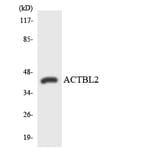 Western Blot - Anti-ACTBL2 Antibody (R12-2440) - Antibodies.com