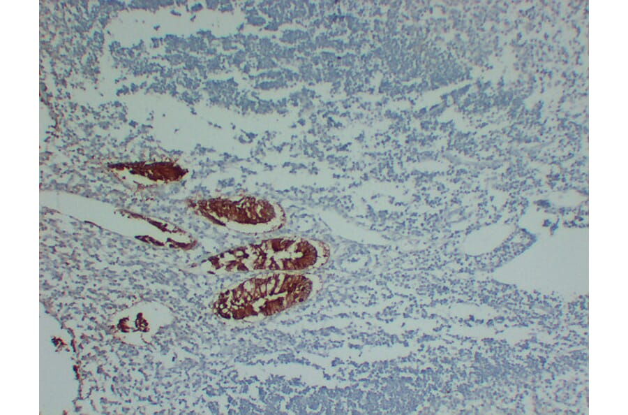 Immunohistochemistry - Anti-Villin Antibody (V0138) - Antibodies.com