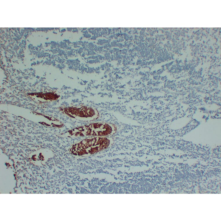 Immunohistochemistry - Anti-Villin Antibody (V0138) - Antibodies.com