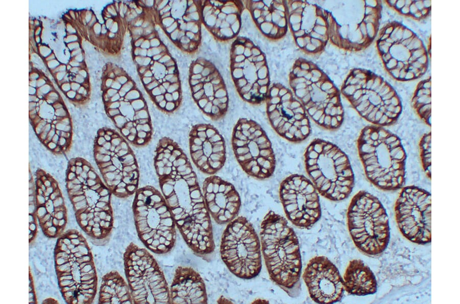 Immunohistochemistry - Anti-Villin Antibody (V0138) - Antibodies.com