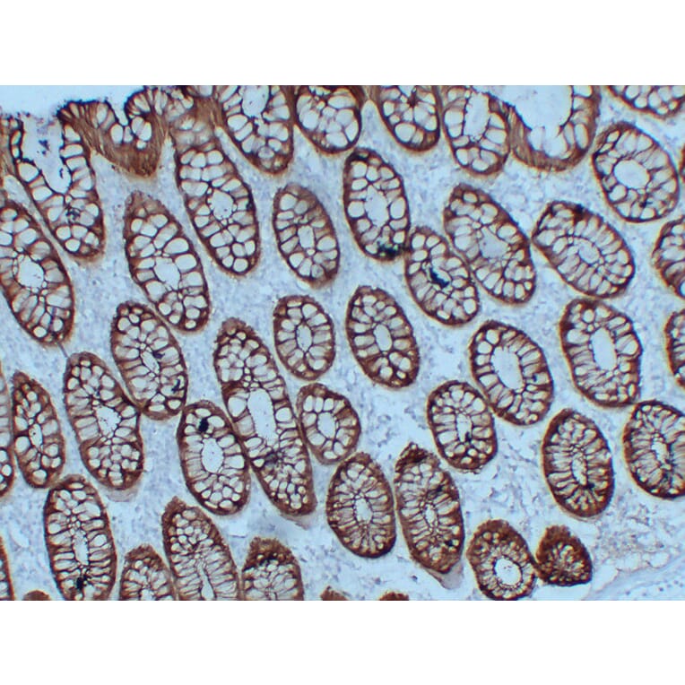 Immunohistochemistry - Anti-Villin Antibody (V0138) - Antibodies.com