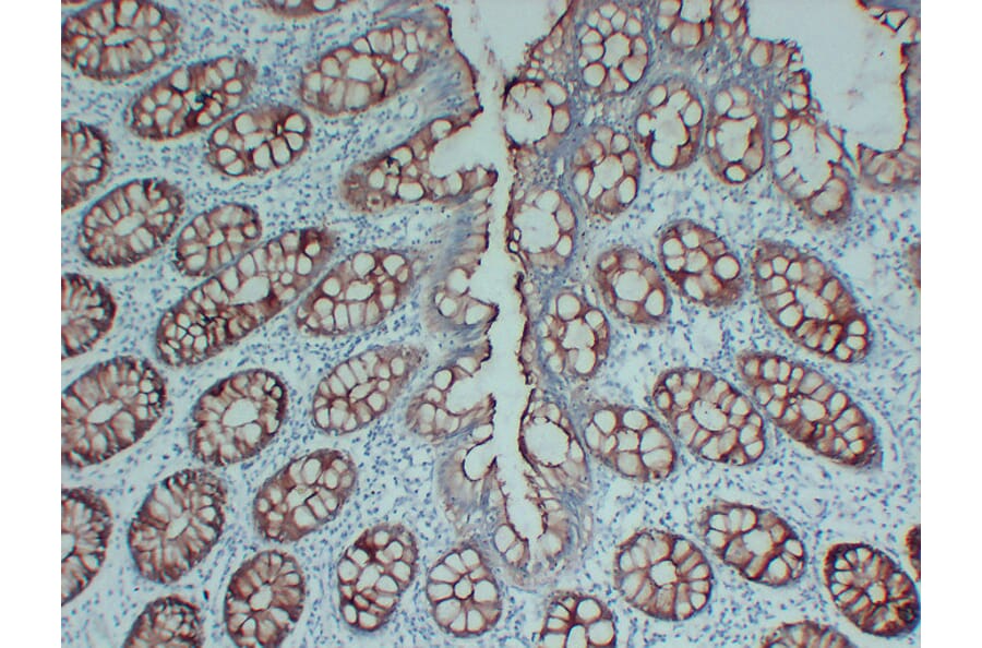 Immunohistochemistry - Anti-Villin Antibody (V0138) - Antibodies.com