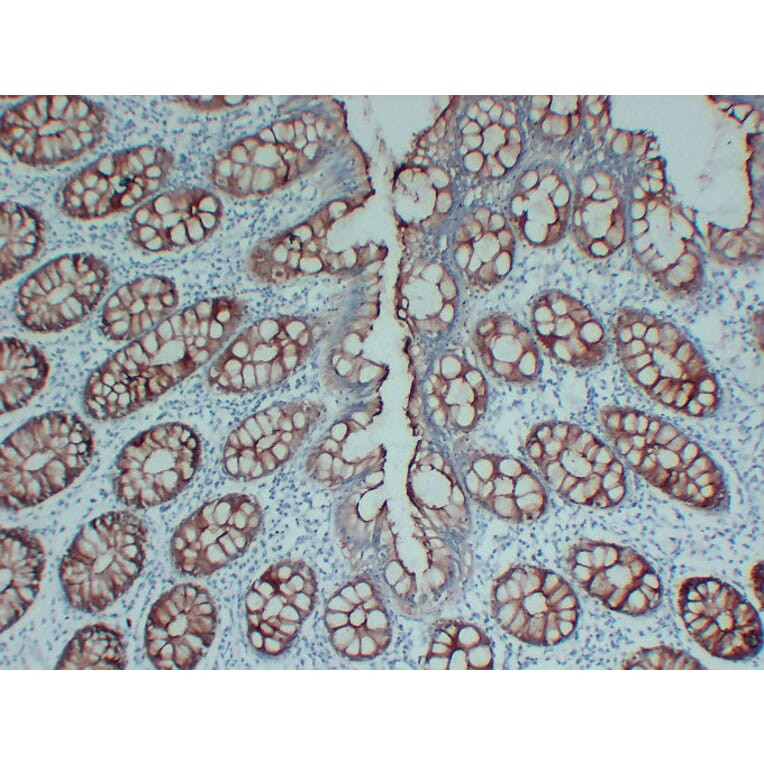 Immunohistochemistry - Anti-Villin Antibody (V0138) - Antibodies.com