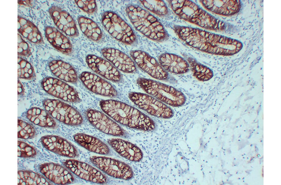Immunohistochemistry - Anti-Villin Antibody (V0138) - Antibodies.com