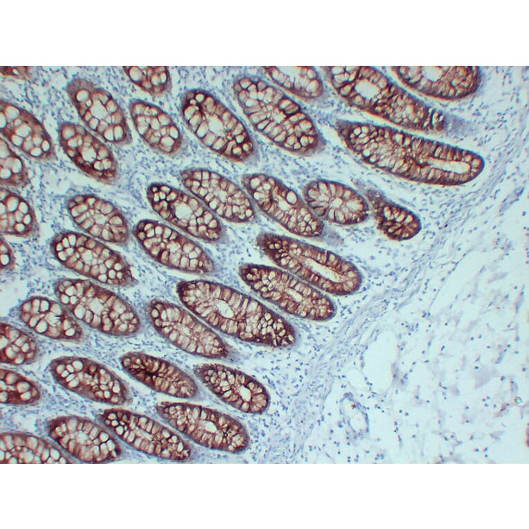 Immunohistochemistry - Anti-Villin Antibody (V0138) - Antibodies.com