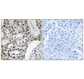 Immunohistochemistry - Anti-ZMYM4 Antibody (C19587) - Antibodies.com