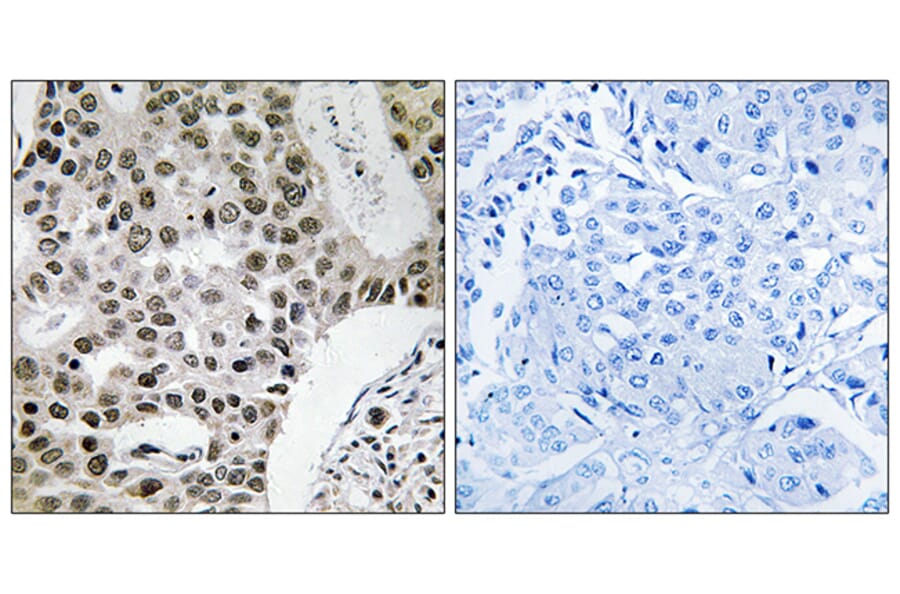 Immunohistochemistry - Anti-ZMYM4 Antibody (C19587) - Antibodies.com
