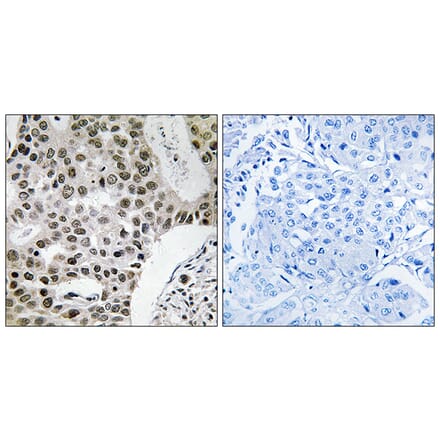 Immunohistochemistry - Anti-ZMYM4 Antibody (C19587) - Antibodies.com