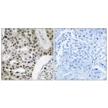 Immunohistochemistry - Anti-ZMYM4 Antibody (C19587) - Antibodies.com
