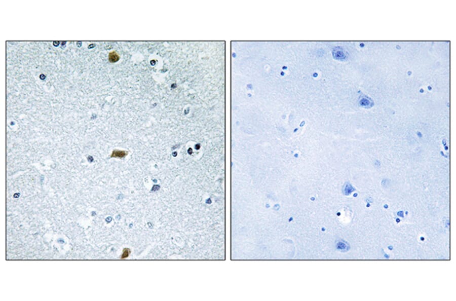 Immunohistochemistry - Anti-ZFHX3 Antibody (C11114) - Antibodies.com