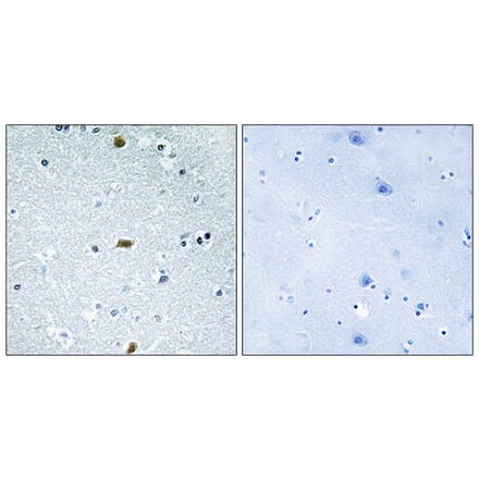 Immunohistochemistry - Anti-ZFHX3 Antibody (C11114) - Antibodies.com