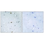 Immunohistochemistry - Anti-ZFHX3 Antibody (C11114) - Antibodies.com