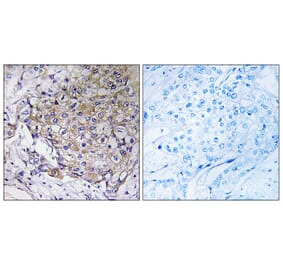 Immunohistochemistry - Anti-WASF3 Antibody (C19561) - Antibodies.com