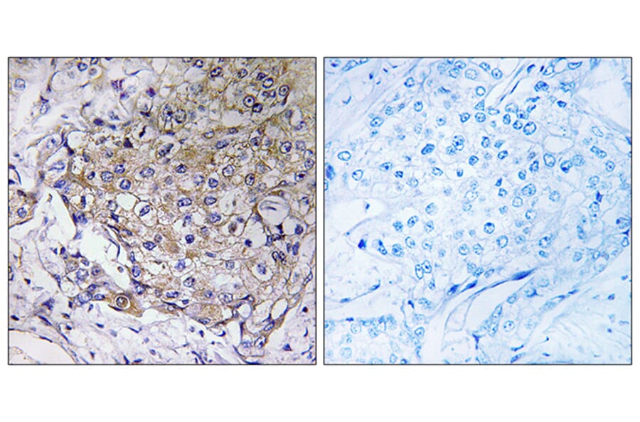 Immunohistochemistry - Anti-WASF3 Antibody (C19561) - Antibodies.com
