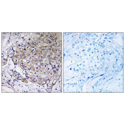 Immunohistochemistry - Anti-WASF3 Antibody (C19561) - Antibodies.com